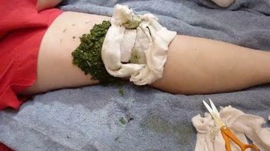 Power of Natural Herbal Remedies - The Lost Book Of Remedies Survival Book You Must Need (TODAY) 🔥