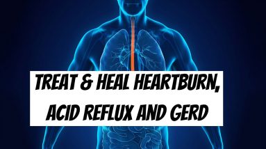 Natural Home Remedies to Prevent Treat and Heal Heartburn, Acid Reflux and GERD