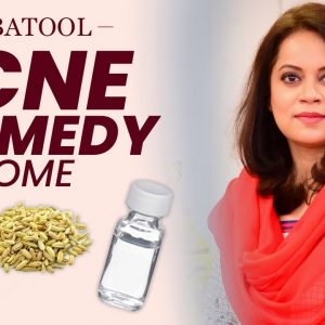 How to Get Rid of Acne and Pimples | Doctor's Suggestion| Acne Remedies that ACTUALLY WORKS