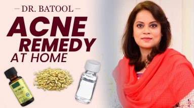 How to Get Rid of Acne and Pimples | Doctor's Suggestion| Acne Remedies that ACTUALLY WORKS