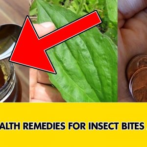 ✅Home remedies for insect bites || Insect bite treatment