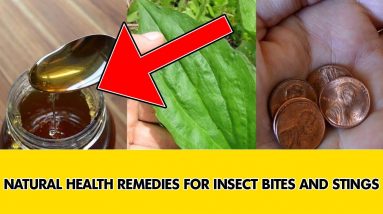 ✅Home remedies for insect bites || Insect bite treatment