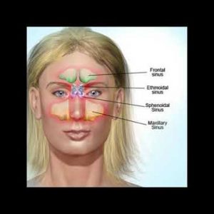 Defeat Black Fungus with home remedies