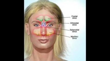 Defeat Black Fungus with home remedies