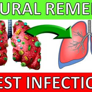 5 Natural Chest Infection Treatments (Home Remedies)
