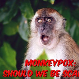 Monkeypox Should We Be Scared?